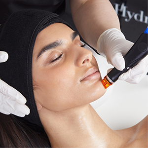 hydrafacial_sm