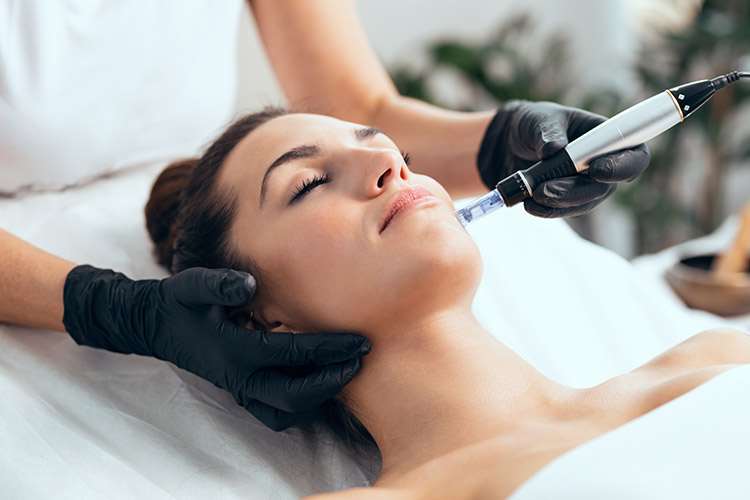 Microneedling_SkinPen Microneedling_SkinPen